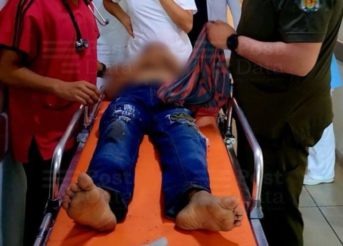 Niño sufre descarga eléctrica al manipular una bocina